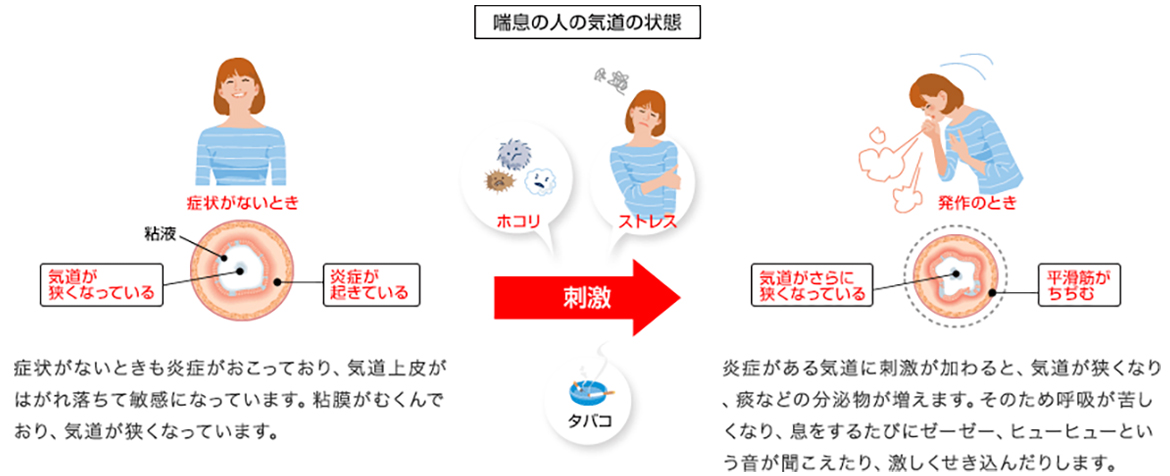 発症のしくみ