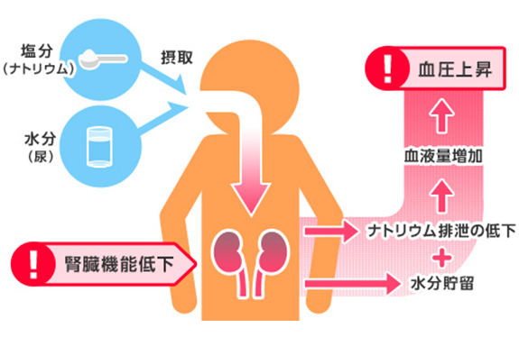 高血圧がまねく病気③・・・腎臓にも影響します。